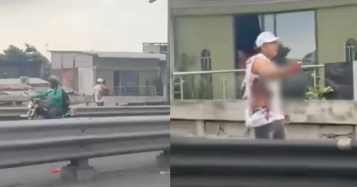 Man Loses Part of Hand After Explosion in Guayaquil